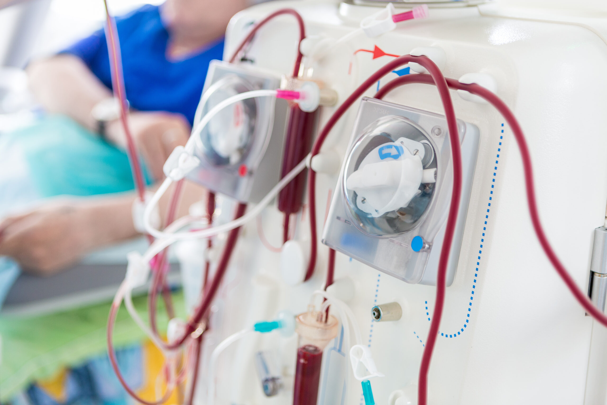 Understanding Dialysis: What You Need to Know